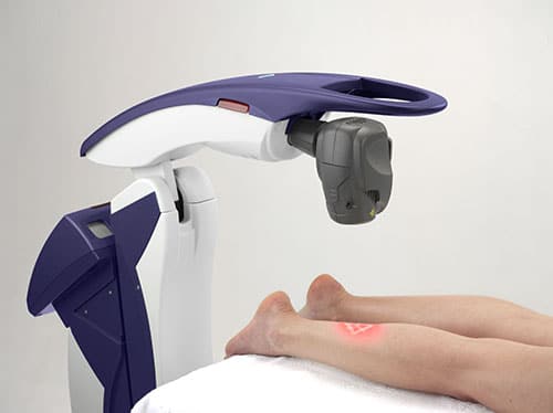 Robotic Laser